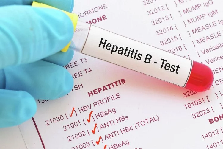 Ünlü profesörden hepatit uyarısı: 1998'den önce doğanlar test yaptırmalı