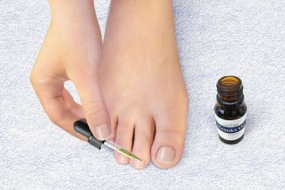  Tırnak mantarına karşı 5 doğal tedavi