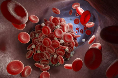 Damar tıkanıklığını açan 10 besin