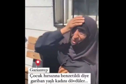 Yaşlı kadına tekme atan şüpheliden garip savunma: Erkek sandım!