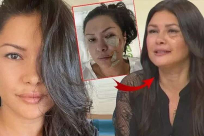 Tuğba Altıntop köpek saldırısına uğradığı günü anlattı!