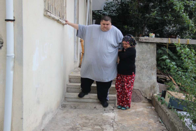 Obezite hastası genç, 300 kiloya ulaştı