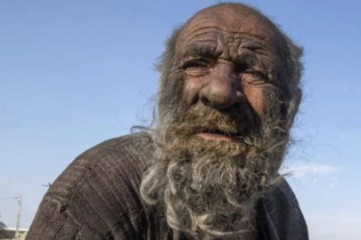 50 yıldır duş almayan Hacı amca hayatını kaybetti