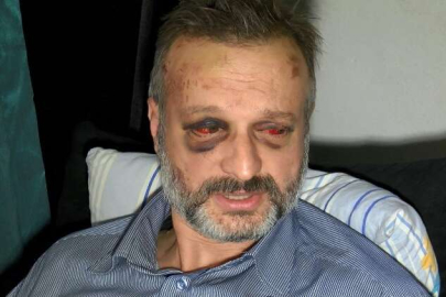 Müzisyeni döven 9 kişi serbest kaldı!