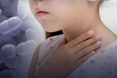 Griple karıştırmayın, geç kalınırsa ölümcül! Strep A'nın en net belirtisi...