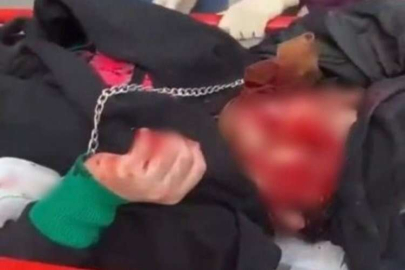 Dini nikahlı eski eşinin saldırısına uğradı!