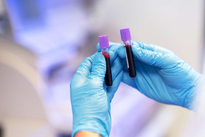 Yağ dokusundan kök hücre tedavisi ile etkili çözüm