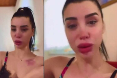 Aleyna Eroğlu'dan futbolcu Karadeniz iddiası: Gördüğüm ilk şiddet değildi