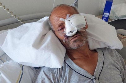 Elektrikli testere dehşeti! Yüzü kesildi, gözünü kaybetme riski var