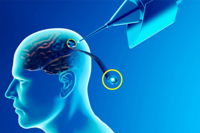 Elon Musk'ın şirketi Neuralink onay aldı: Beyin çipi deneyleri başlıyor