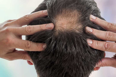 Bir damlası bile yetiyor! Temas ettiği yerden kıl çıkıyor..