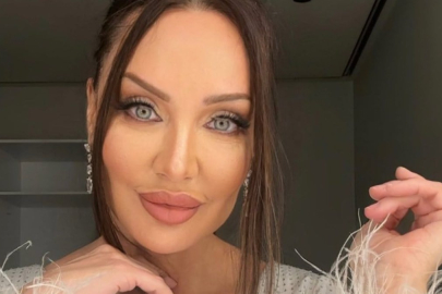 Umut Akyürek'in son yaptırdığı estetik operasyon şoke etti: Alın daraltma