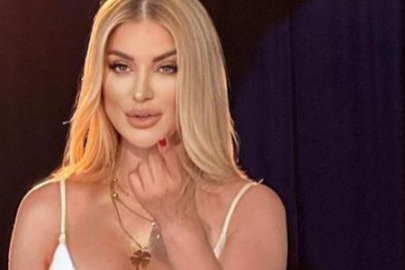 Estetiği abartan Songül Karlı'nın gözünün son halini görenleri şaşırttı