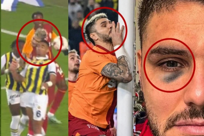 Mauro Icardi'nin gözü ne zaman morardı