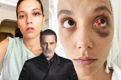 Ozan Güven'in eski sevgilisi Deniz Bulutsuz'a darp davasında Adli Tıp Kurumu raporu hazırlandı