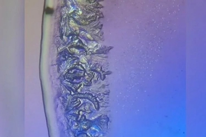 Gözyaşını mikroskop altında inceledi