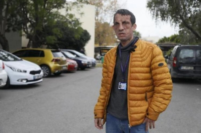 Türkiye'de ilk kez yüz nakli yapılan Uğur Acar: Sağlık alanında bir bölüm okumak istiyorum