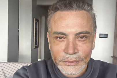 Erkeklerde estetik furyası! Cenk Eren de yüzünü gerdirdi