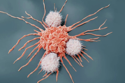 Erkeklerde ve kadınlarda en sık görülen kanser türleri açıklandı