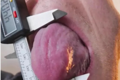 Diliyle Guinness rekortmeni oldu! Dünyanın en büyük diline sahip…