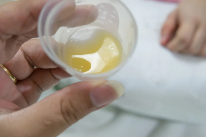 Kolostrum sütü nedir, faydaları nelerdir?