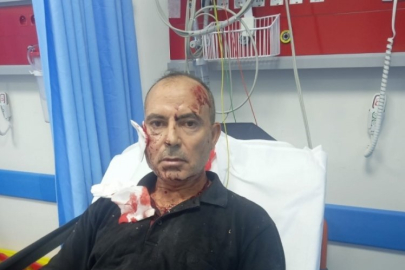 Bursa'da vatandaşı parçalayan Kangal köpeğinin sahibi gözaltına alındı