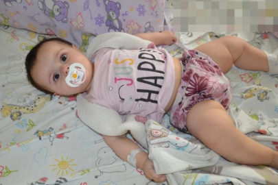 Çorum'da bağırsakları düğümlenen bebek ameliyatsız tedavi edildi