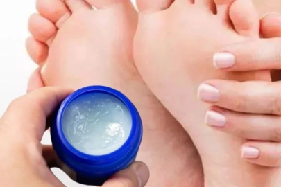 Ayağınızın altına Vicks sürmek bakın neye sebep oluyor! İşte şaşırtan faydası