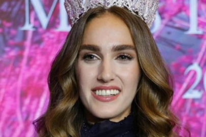 Miss Turkey birincisi İdil Bilgen'in son hali şaşırttı! Estetik iddiaları gündeme geldi