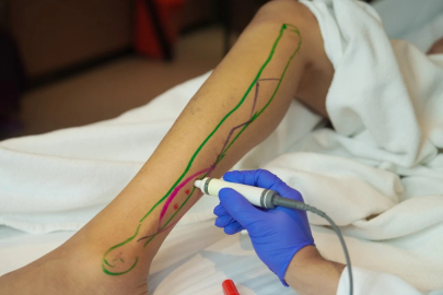 Yara onarımında yeni dönem: Deri ve doku transferi