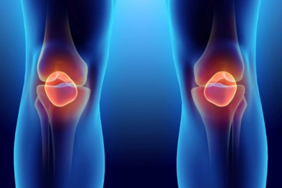 Menisküs yırtığı nedir, nasıl tedavi edilir? Op. Dr. Candan açıkladı