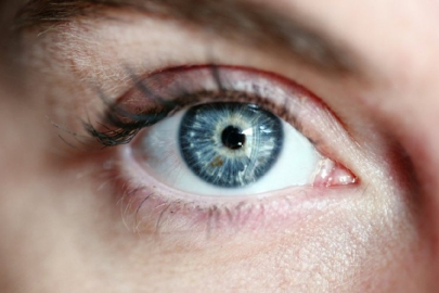 Gözde sinek uçuşmasına dikkat! "Retinada yırtık veya delikler oluşabilir"