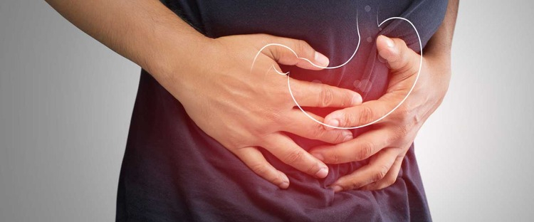 Mide Yanması Nedir?