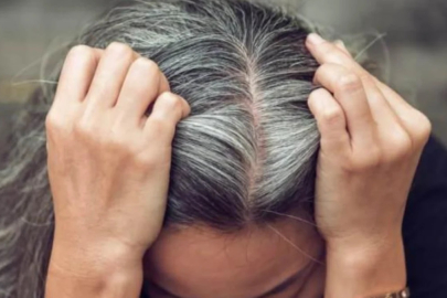 Meğer saç beyazlamasını nedeni o vitaminmiş