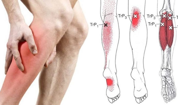 Huzursuz Bacak Sendromu Nedenleri Nelerdir?