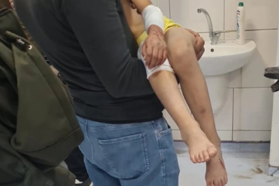 Malatya'da sokakta oynayan çocuğa 6 köpek saldırdı