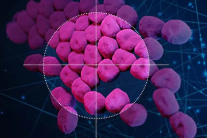 Yapay zeka, ilaca dirençli enfeksiyonları tespit etmek için kullanılıyor