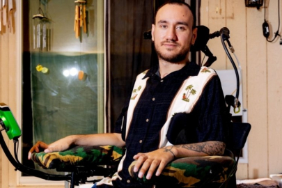 Musk beynine çip takmıştı: Mahremiyetim kalmadı!