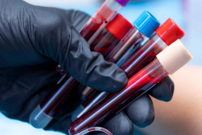 En halsiz kan grubu belli oldu!