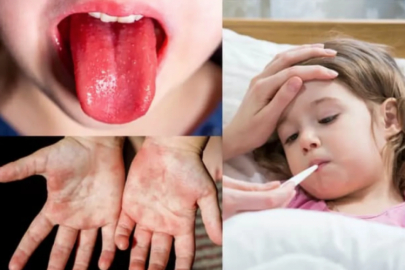 Komşuda Strep-A bakteri paniği: Okullar tatil ediliyor