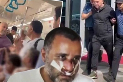 Çocuklarının gözü önünde dövülen baba sessizliğini bozdu! Gözyaşlarıyla anlattı..