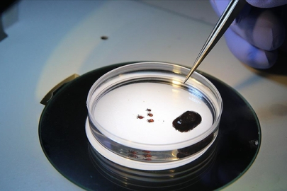 Sağlık Bakanlığından "Kırım Kongo Kanamalı Ateşi" uyarısı