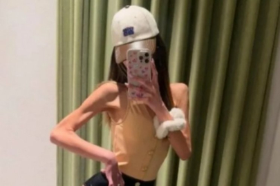 Ailesi '2 kez kalbi durdu' demişti! Nihal Candan 29,5 kiloya kadar düşmüş