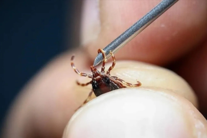 Kırıkkale'de vücuduna yapışan keneyi çıkartan çocuğun testi pozitif çıktı