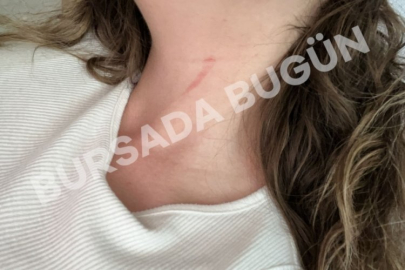 Bursa'nın göbeğinde genç kadın dehşeti yaşadı...