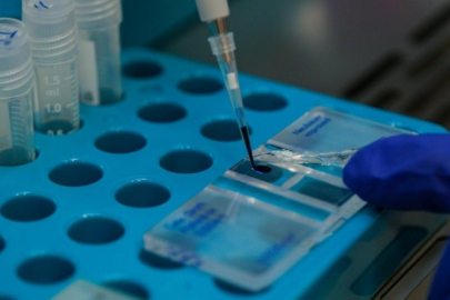 KKKA aşısı için klinik öncesi çalışmalarda sona gelindi