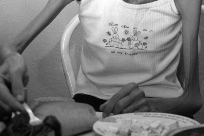 Anoreksiya nedir, belirtileri nelerdir?