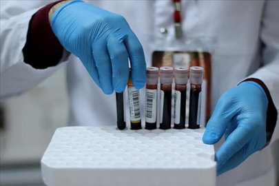 Yeni kan grubu keşfedildi: Dünyada sadece bir kadında var