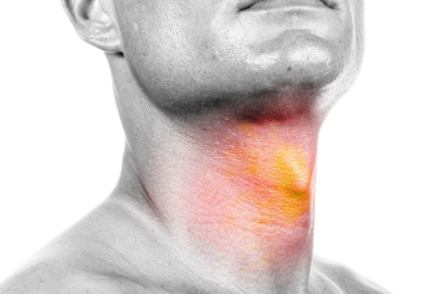 Boyunda fark edilen şişlikler ciddiye alınmalı