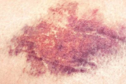 Bu belirtiler sinsice geliyor: Fark etmesi zor ama sonuç ağır!